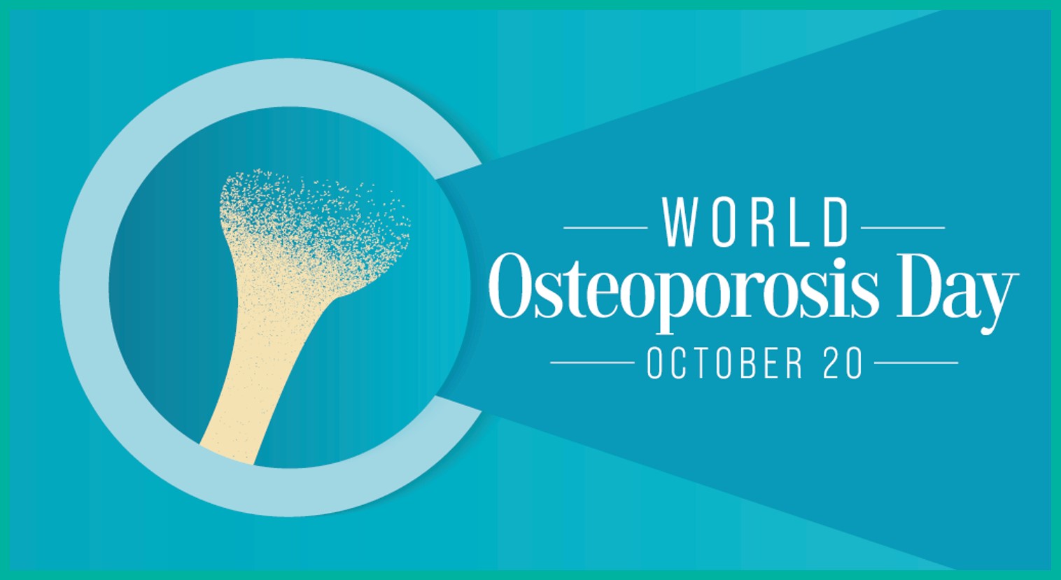 Osteoporosis a global health problem Biomedica