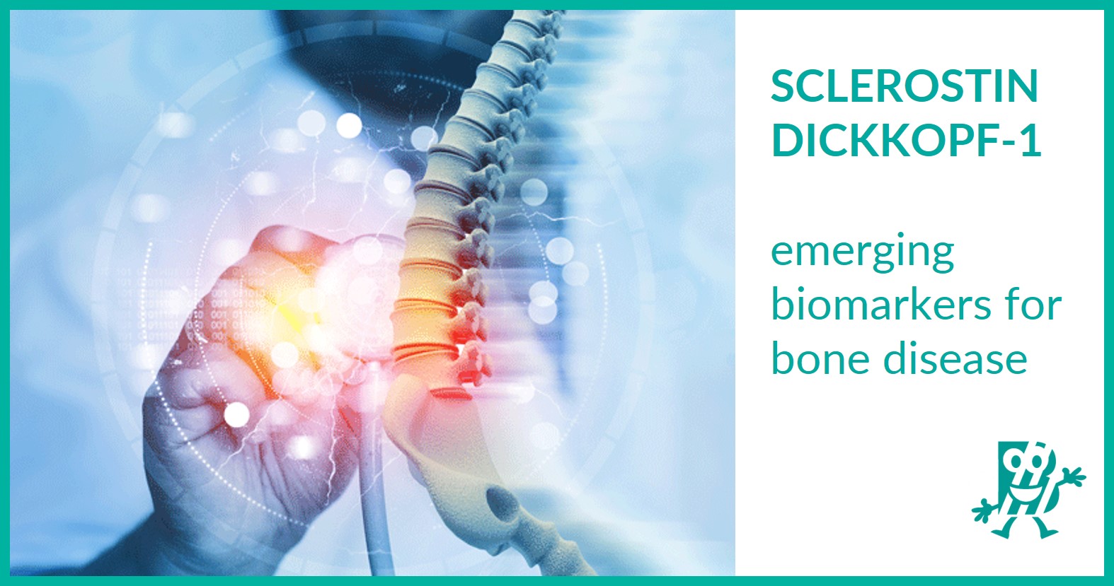 Sclerostin and DKK1 emerging biomarkers for bone disease Biomedica